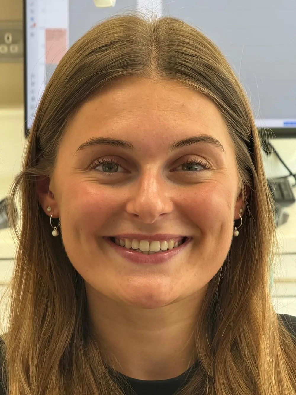 A patient's smile before Invisalign, with crowded and overlapping front teeth