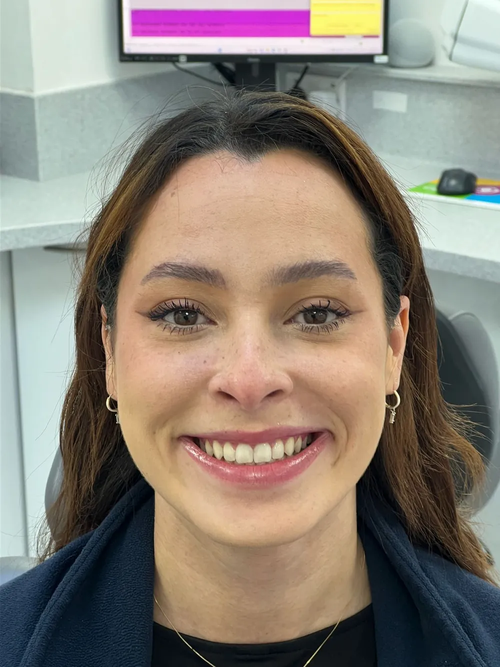 The same patient's smile after Invisalign, with an even, aligned arch