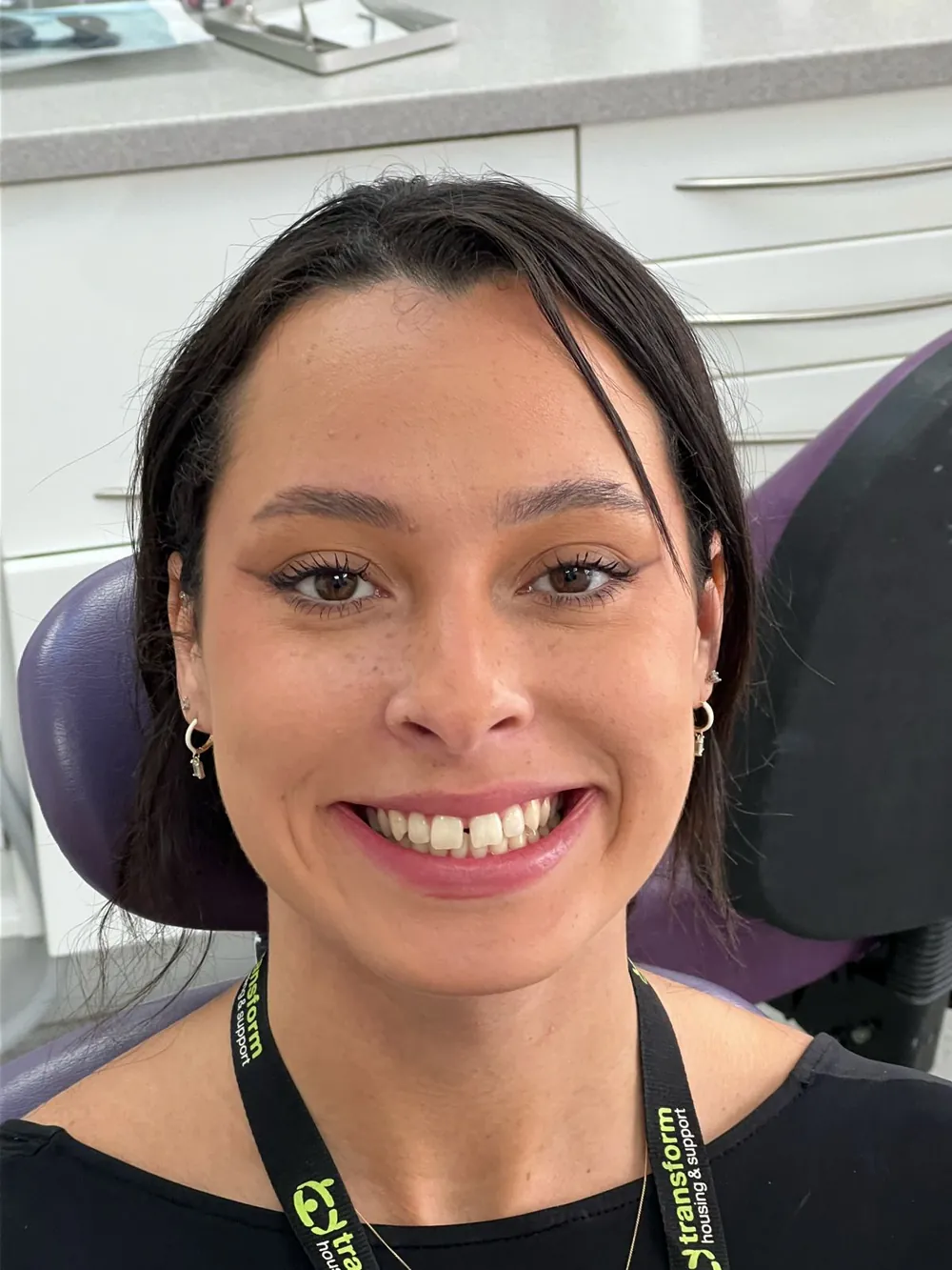 A patient's smile before Invisalign, with an uneven upper arch